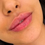 مطب پوست،مو ، زیبایی ولیزر
