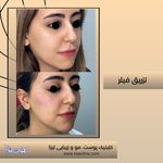 مطب پوست مو زیبایی فردوس شرق