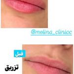 کلینیک تخصصی پوست و زیبایی ملینا