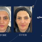 کلینیک زیبایی آرا مهر