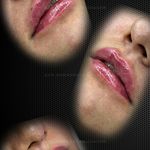 کلینیک تخصصی لیزر پوست مو زیبایی آی‌تا