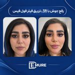 کلینیک زیبایی و جوانسازی دمور