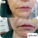 کلینیک زیبایی بوتاکس لیزر فیلر شجاعی