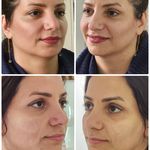 کلینیک زیبایی و لیزر مایا (دکتر وحیدی)