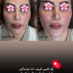 مرکز لیزر و کلینیک زیبایی پریفا