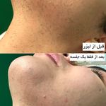 مرکز لیزر وکلینیک زیبایی پایون(بانوان)