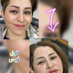 خدمات زیبایی دکتر بهمن صفدری