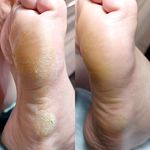 آموزش تخصصی کاشت ناخن_پدیکور اوین گرگانی