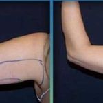 کلینیک زیبایی الماس کاملا اقساطی