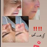 کلینیک فیشال و ماساژ سارن اسکین سارا