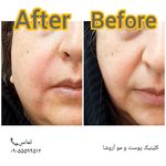 مرکز زیبایی,بوتاکس و لیزر آروشا