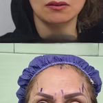 کلینیک زیبایی الماس کاملا اقساطی