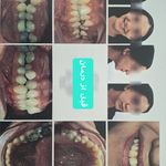 ارتودنسی در فردیس اقساطی بدون