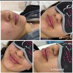 کلینیک تخصصی پوست ،مو،لیزر رزسفید