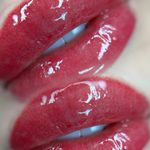 میکروبلیدینگ تخصصی زهرابدلی