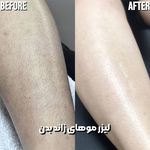 کلینیک زیبایی و لیزر هیرا