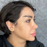 کلینیک پوست سلین - کلینیک پوست و مو - شهر شیراز - 0030