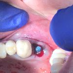 دکتر فرید نیکیان جراح دندانپزشک