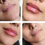 مرکز لیزر کلینیک زیبایی نارسیس