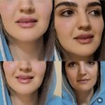 کلینیک زیبایی کاترین