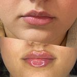 کلینیک لیزر و زیبایی لیلیا