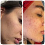 خدمات تخصصی فیشال سارا اسکین بار