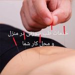 کاهش تضمینی درد با طب سوزنی شفا طب