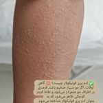 مرکز لیزر زینتی