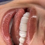 کلینیک طراحی لبخند مایا
