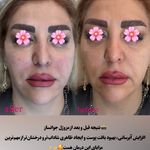 مرکز لیزر و کلینیک زیبایی پریفا