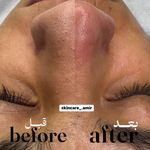 سالن تخصصی کوتاهی مو و فیشیال امیربارویی