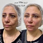 کلینیک تخصصی لیزر ،پوست و‌زیبایی بهشاد