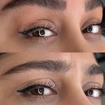 میکروبلیدینگ میناسلمانی