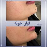 کلینیک زیبایی و لیزر سلن مشهد