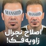 کلینیک زیبایی مانشید