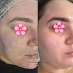 فیشال تخصصی معصومه قاسمی