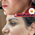 كلينيك زيبايي پوستينو