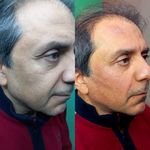 کلینیک زیبایی پارسیان آلفا