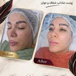 کلینیک لیزر و زیبایی مهسان