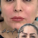 کلینیک زیبایی و لیزر دکتر آزاده اسماعیلی