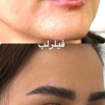 کلینیک زیبایی دریا/دکتر امیر قهرمانی