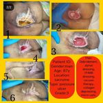 کلینیک زخم شکیبی