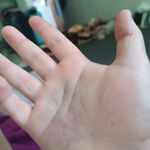 شکسته بندی، طب سنتی استادحکیم