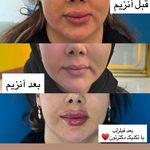 کلینیک زیبایی و لیزر دکتر آزاده اسماعیلی