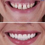 دندانپزشکی پرتو صادقیه از دم قسط با بیمه
