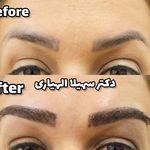 کلینیک تخصصی کاشت موی پرنیان