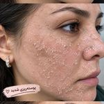 فیشیال / خدمات پوست / سالن زیبایی