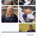 کلینیک فیشال و پاکسازی پوست تمیس