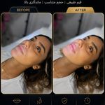 کلینیک تخصصی زیبایی و لیزر موی ابریشم
