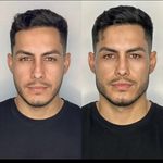 کلینیک ژل بوتاکس لیزر فیل بیوتی